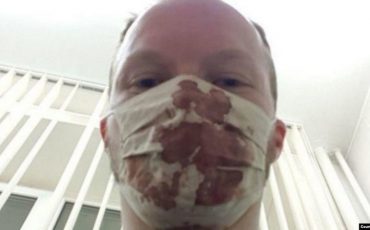 Дзьмітрый Гошка пасьля зьбіцьця