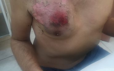 Последствия задержания возле ПВТ / Фото: /nashaniva.by