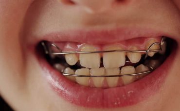 Фото использовано в качестве иллюстрации, vselekari.com