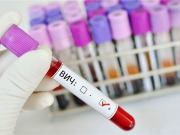 Фото использовано в качестве иллюстрации, gdp1podolsk.ru