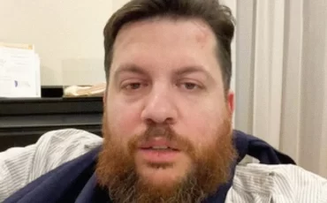 Леонид Волков после нападения / ФБК